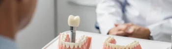 Dental implant and denture comparison model in dentist's office
