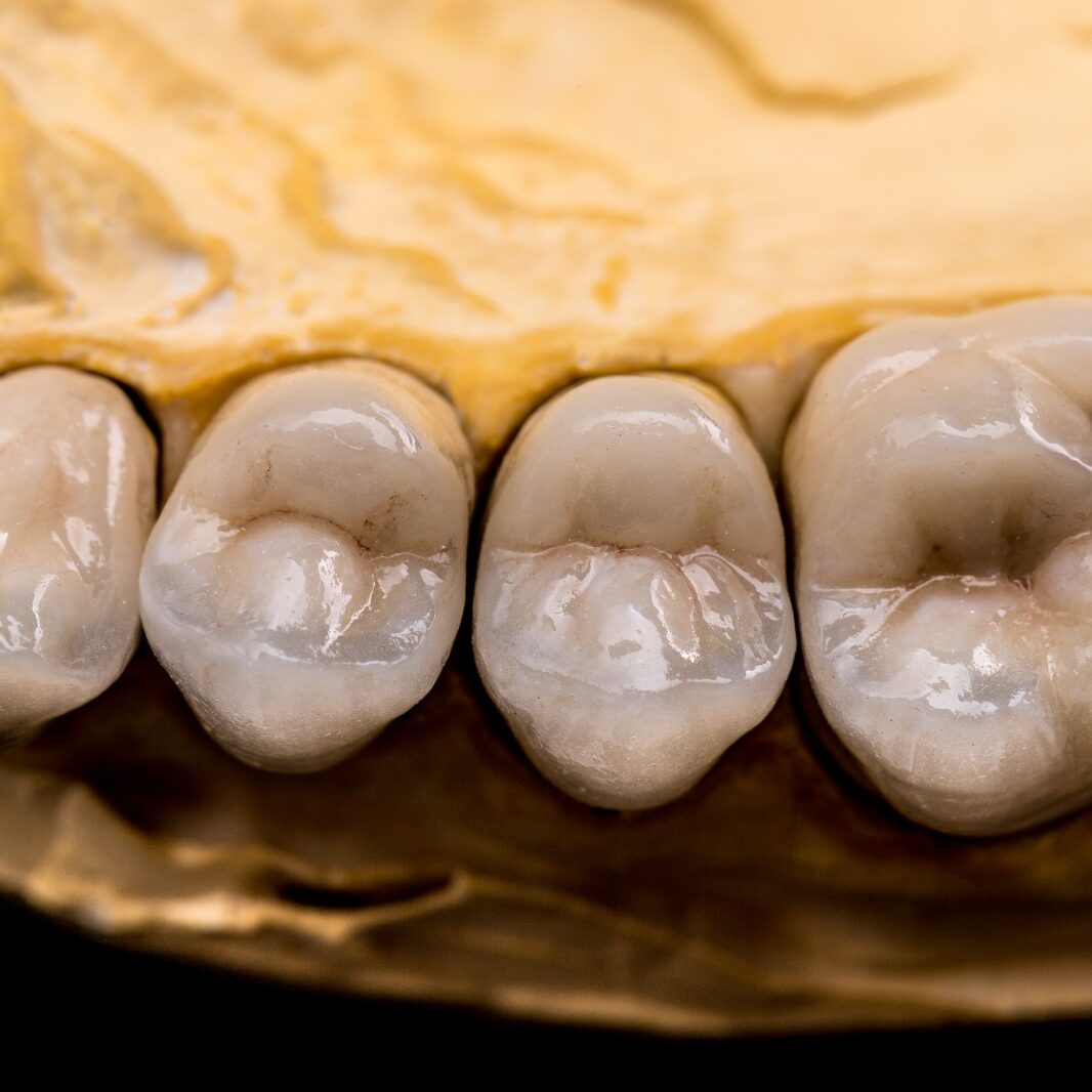 Dental-Se Dental-Se