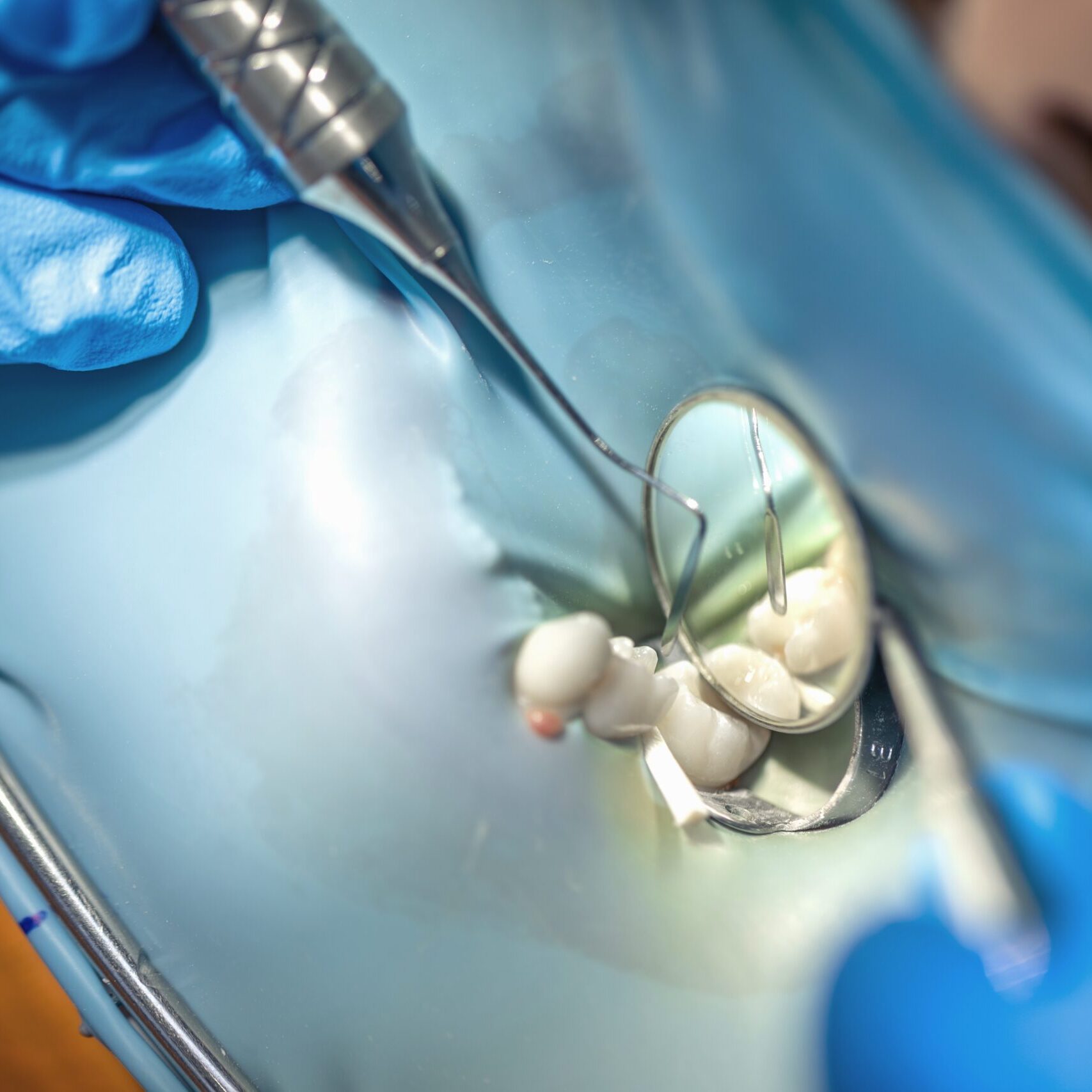 fillings fillings